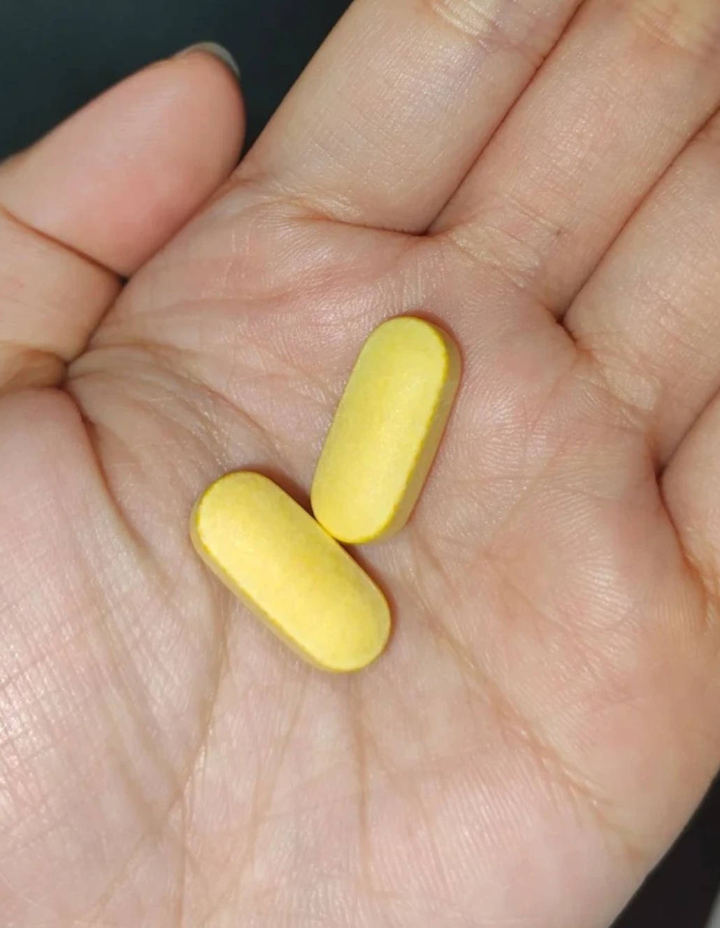 额头出油是怎么回事啊?谢谢!