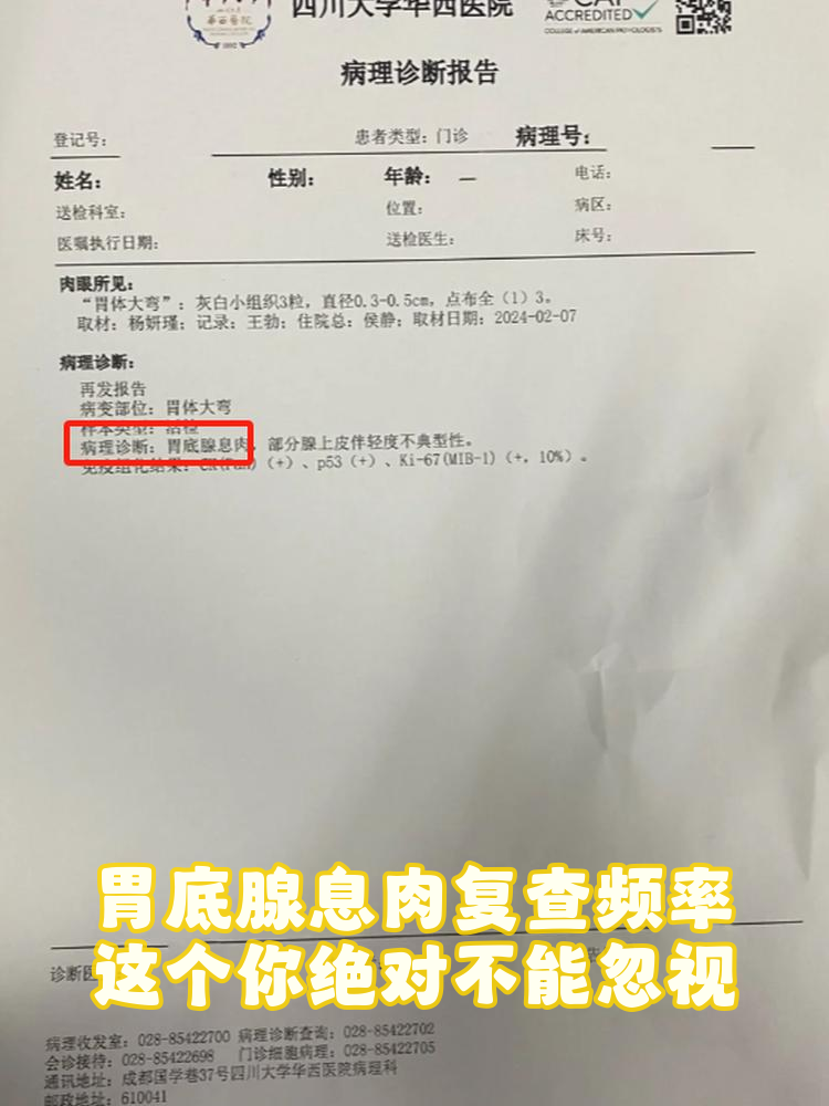 胃多发息肉会很严重吗