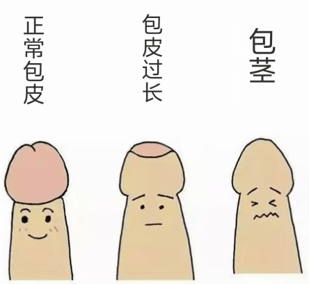 什么样才是包皮过长