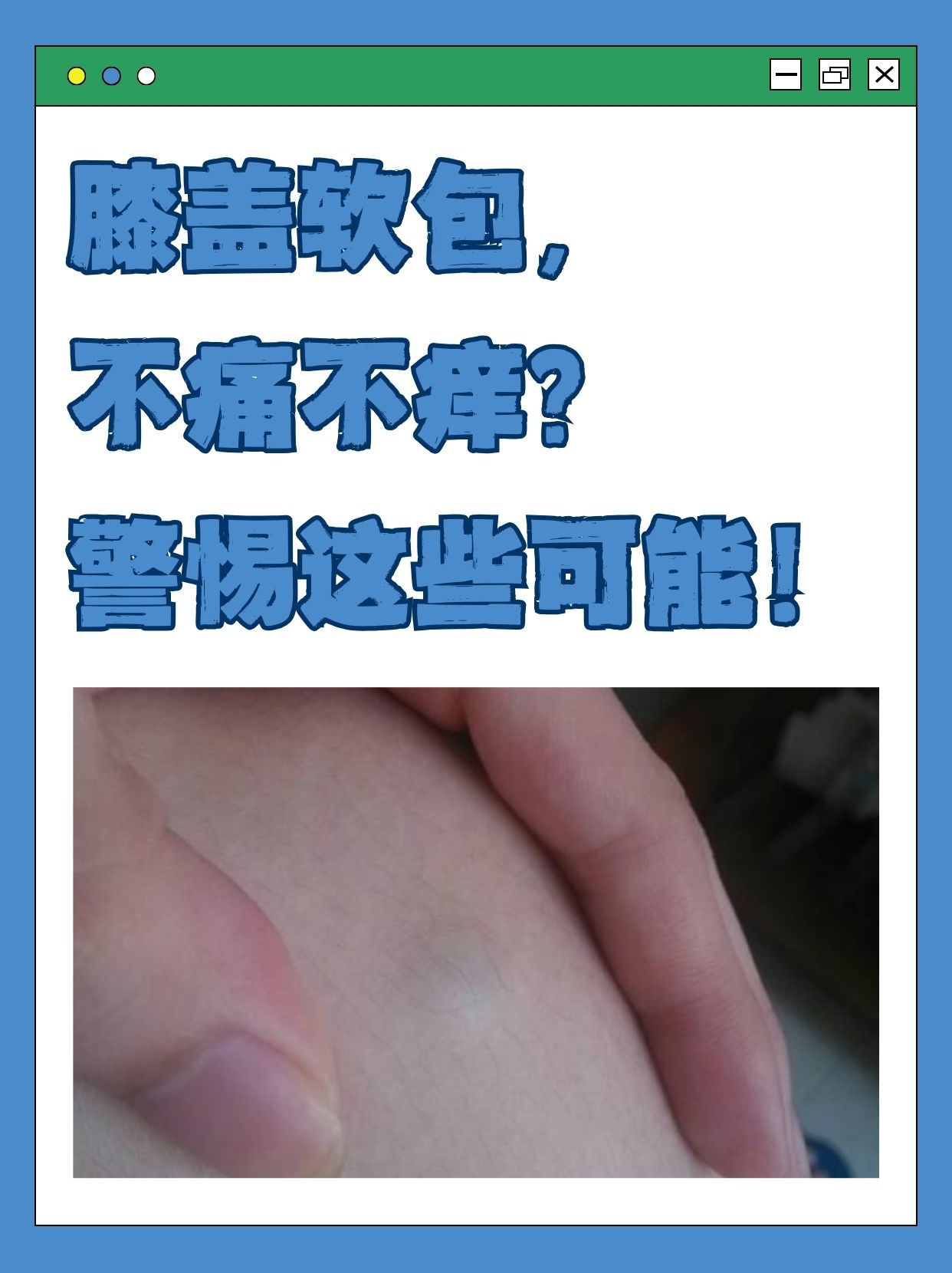 囊肿摸起来是硬的吗?