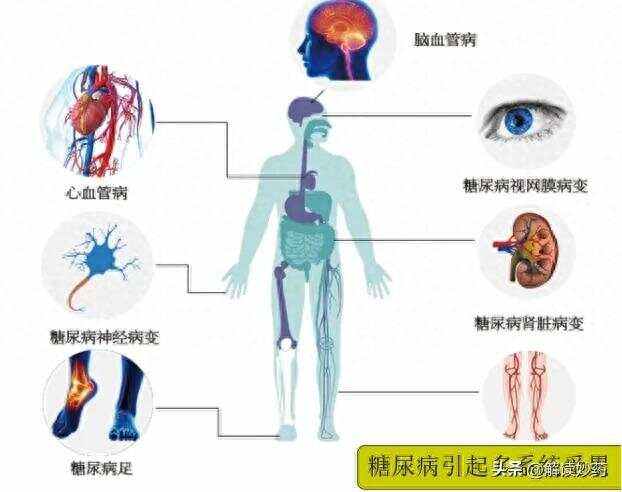 二型糖尿病是什么