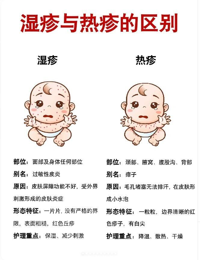 新生儿湿疹怎么护理