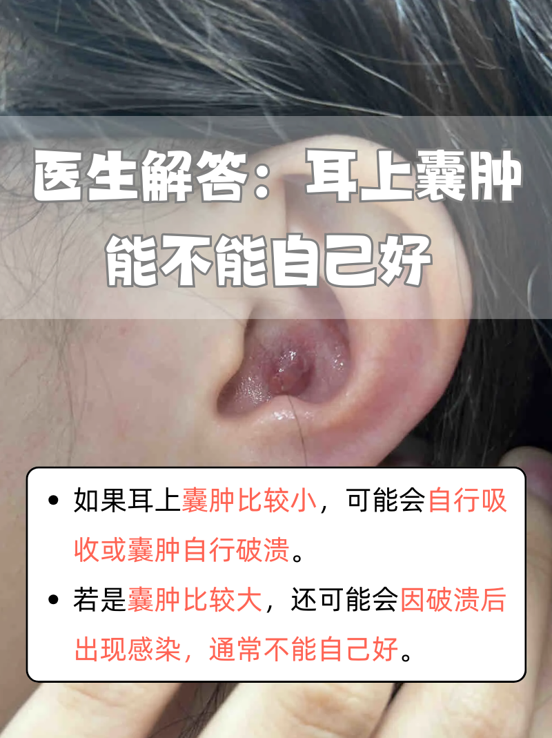 耳朵起个包怎么弄??
