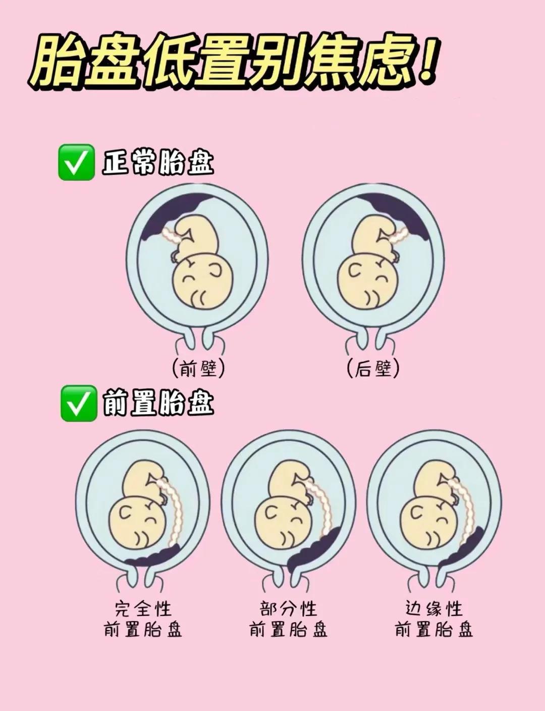 胎儿窘迫的临床表现