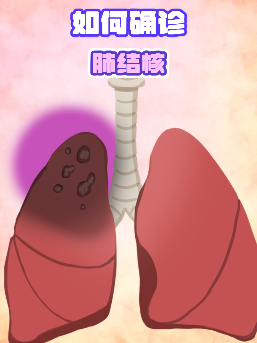 肺结核早期的症状