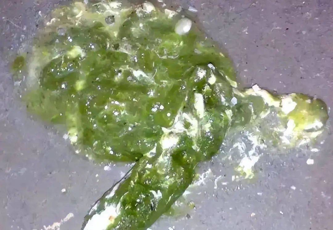 大便是绿色怎么回事