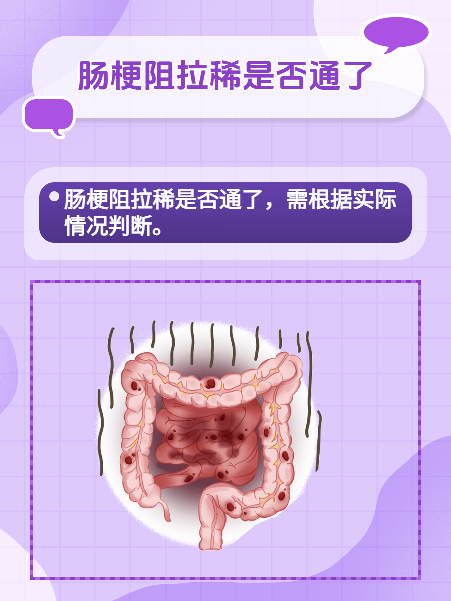 什么是麻痹性肠梗阻?