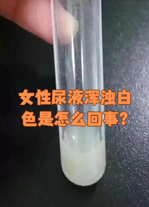小便有白色液体怎么回事呢