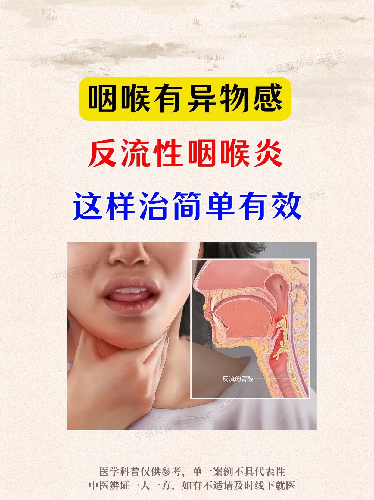 慢性咽炎能根治吗?