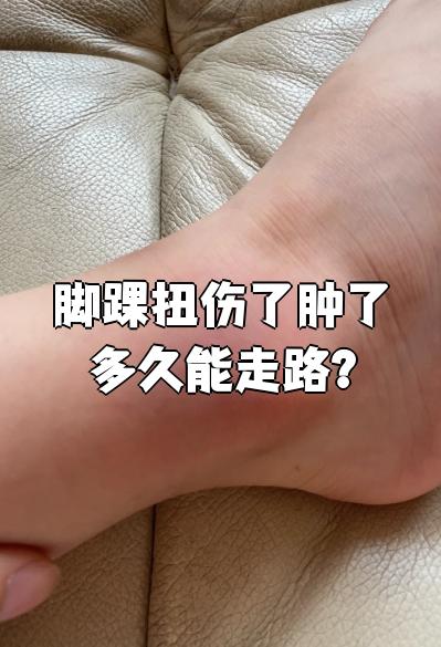 脚踝骨折后多久消肿