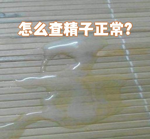 什么颜色的精子是正常的