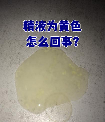 什么颜色的精子是正常的