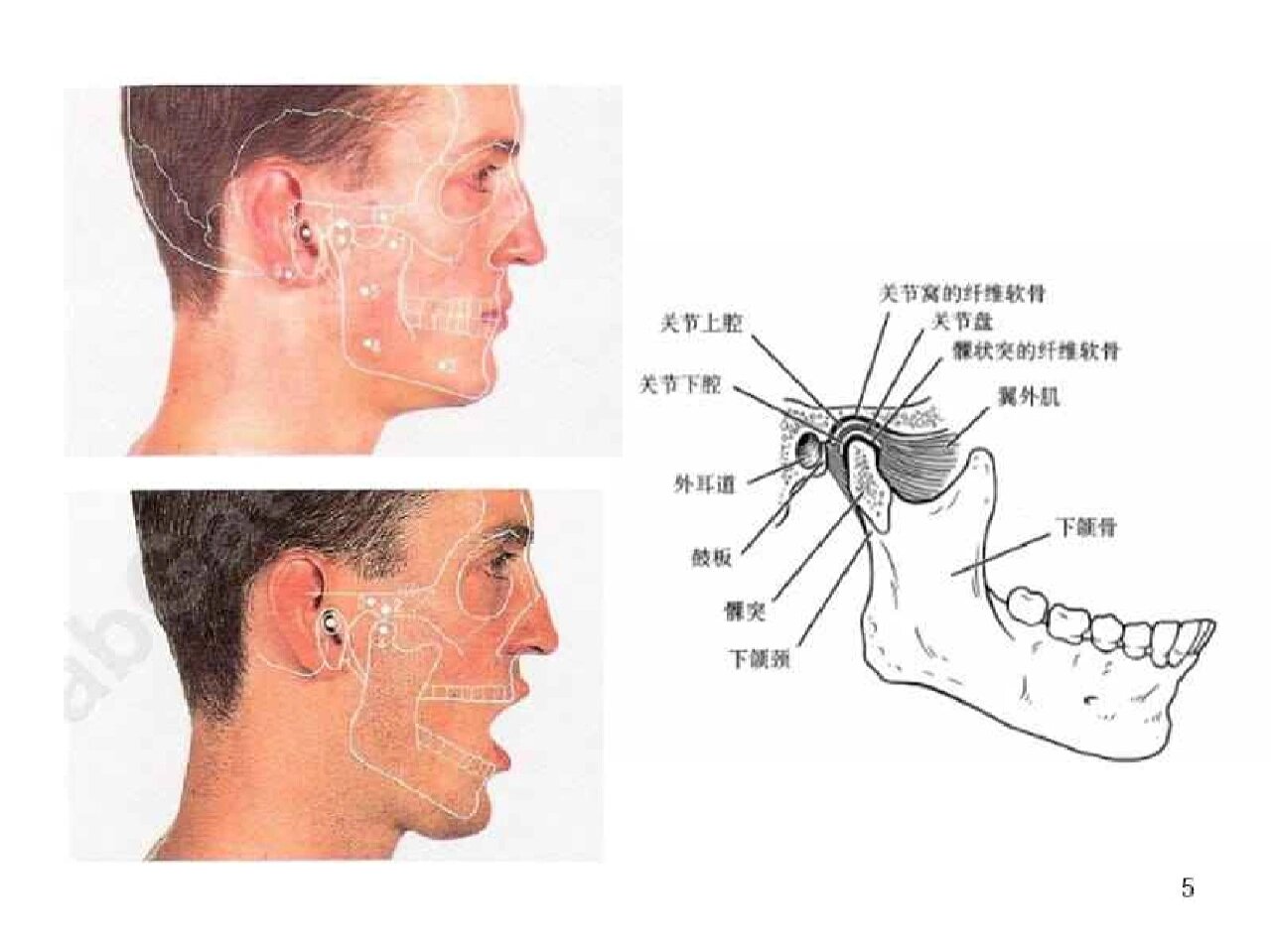 嘴巴张不开可以自愈吗