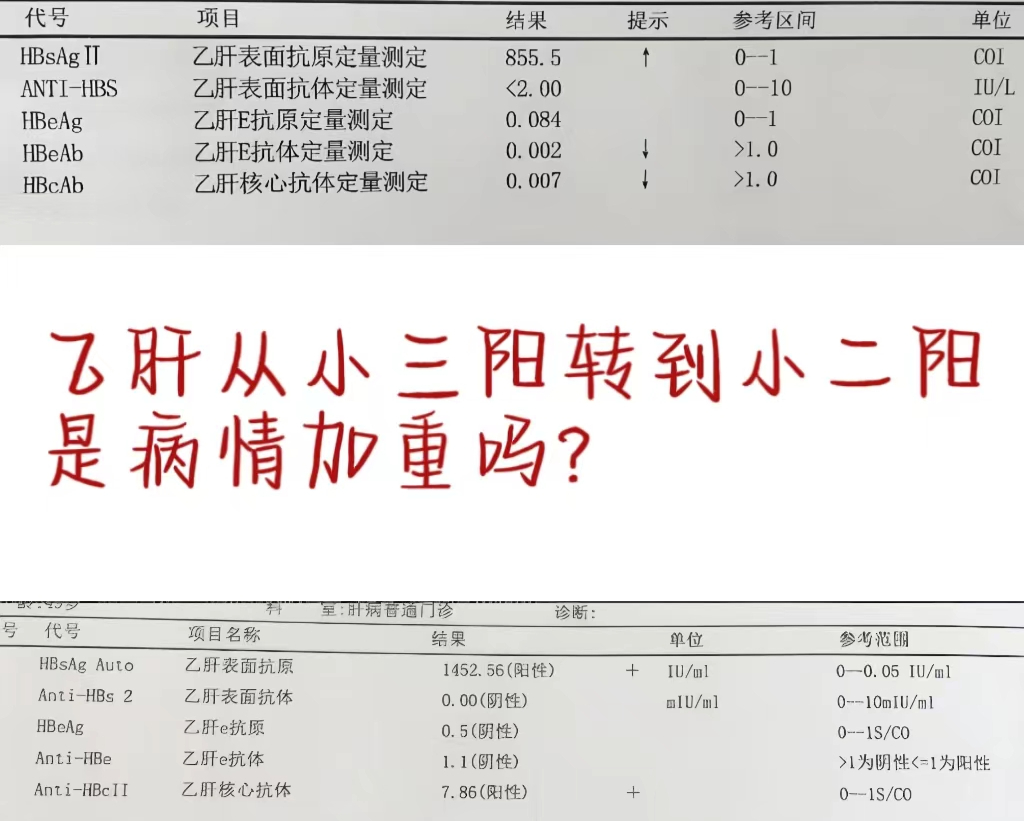 乙型肝炎e抗体阳性是什么意思