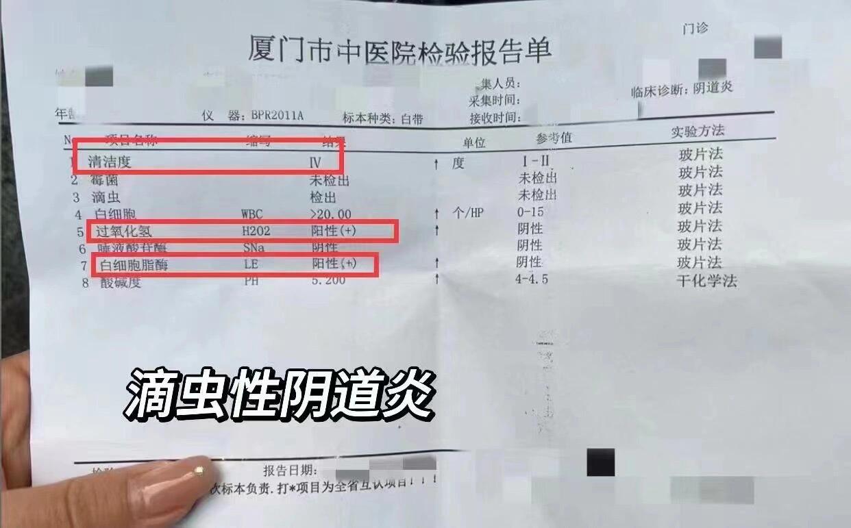 唾液酸酶阴性正常吗