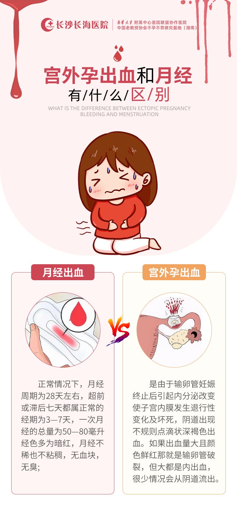 宫外孕什么症状