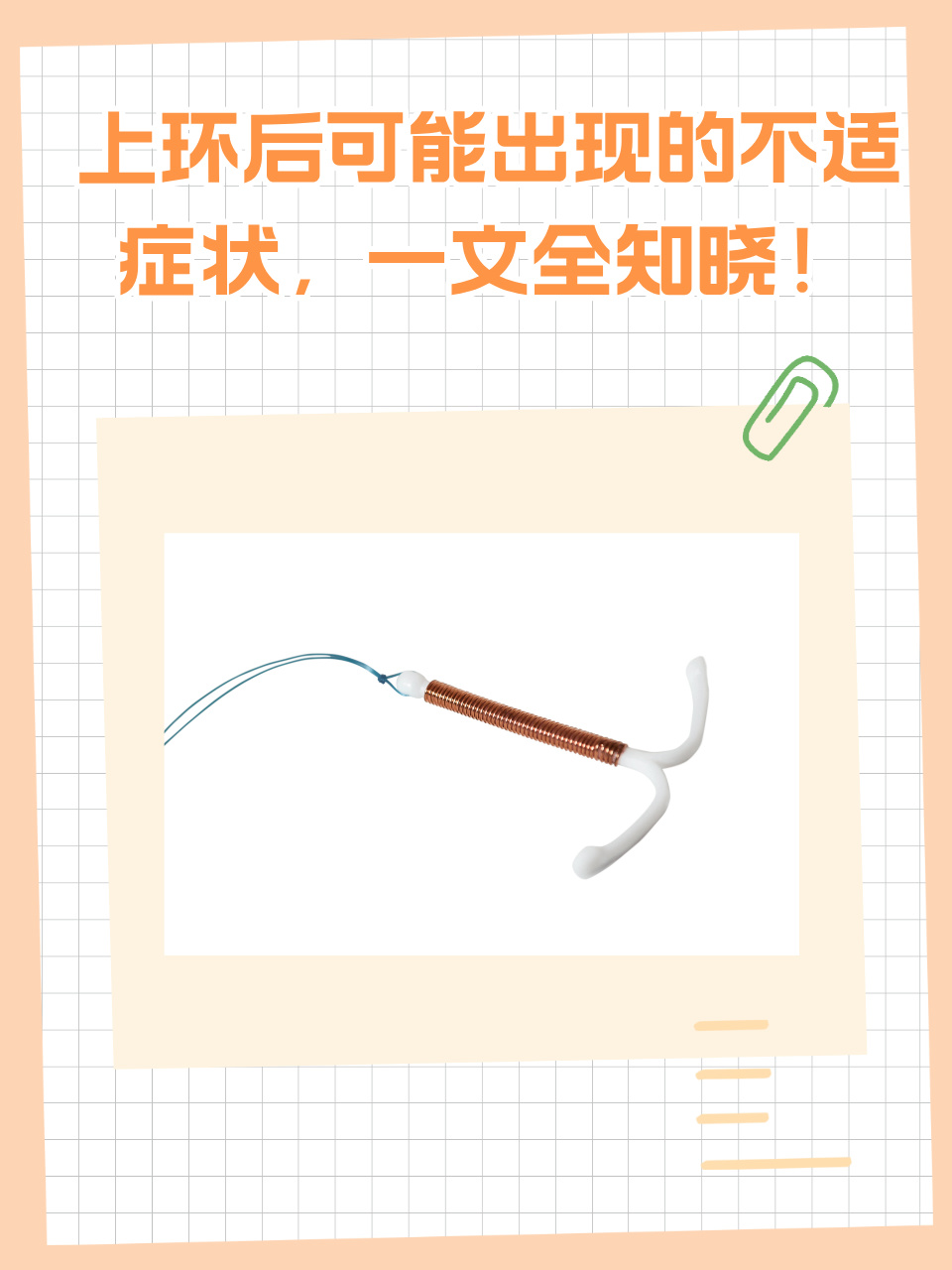 上环后还会怀孕吗