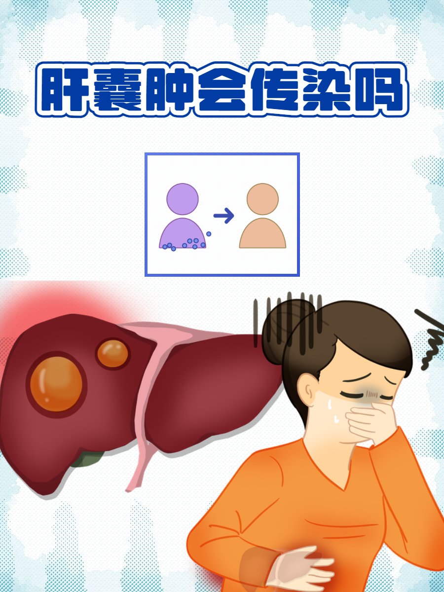 什么是肝囊肿,症状是什么