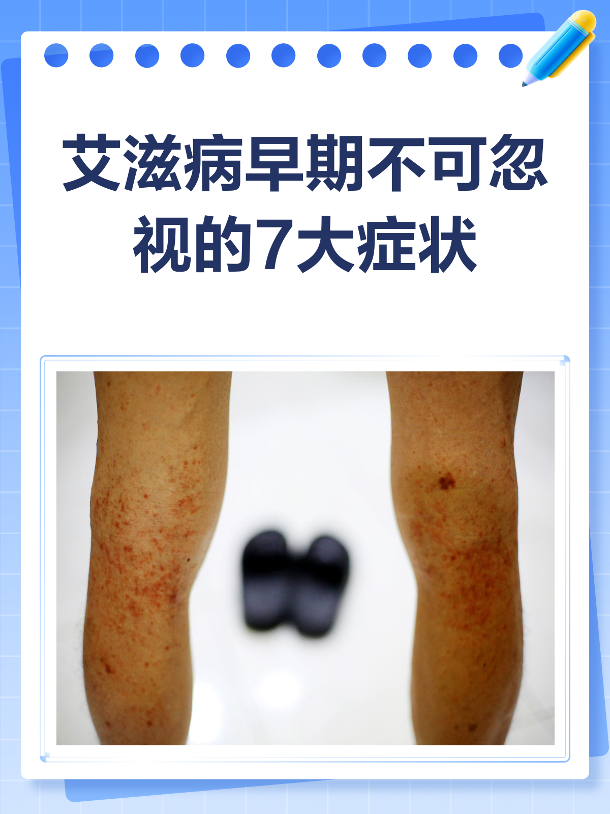 aids指的是什么病?