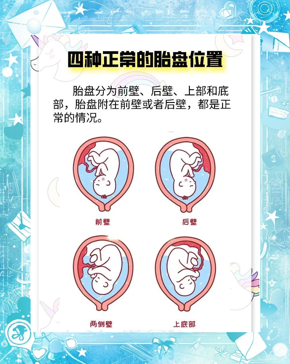 前壁胎盘和后壁胎盘的区别