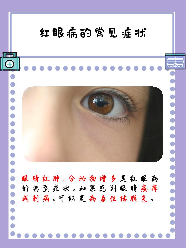 如何判断是否红眼病