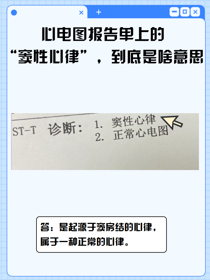 窦性心律是心脏病吗