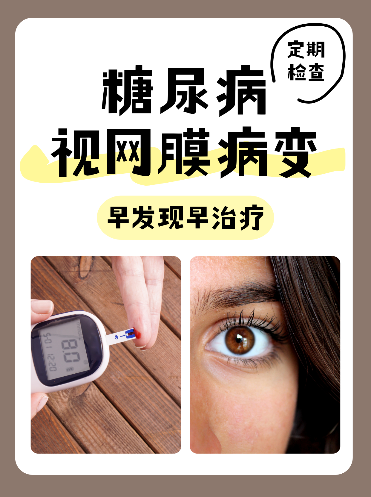 糖尿病性视网膜病变的治疗