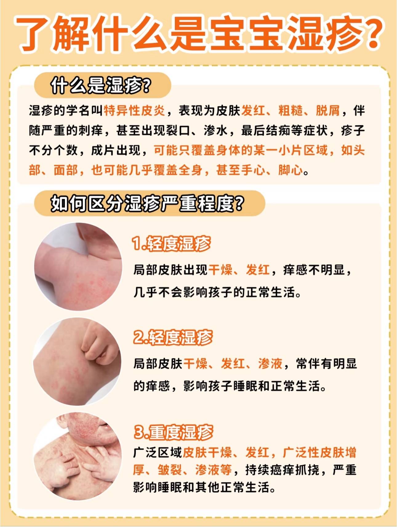 湿疹是怎么引起的?