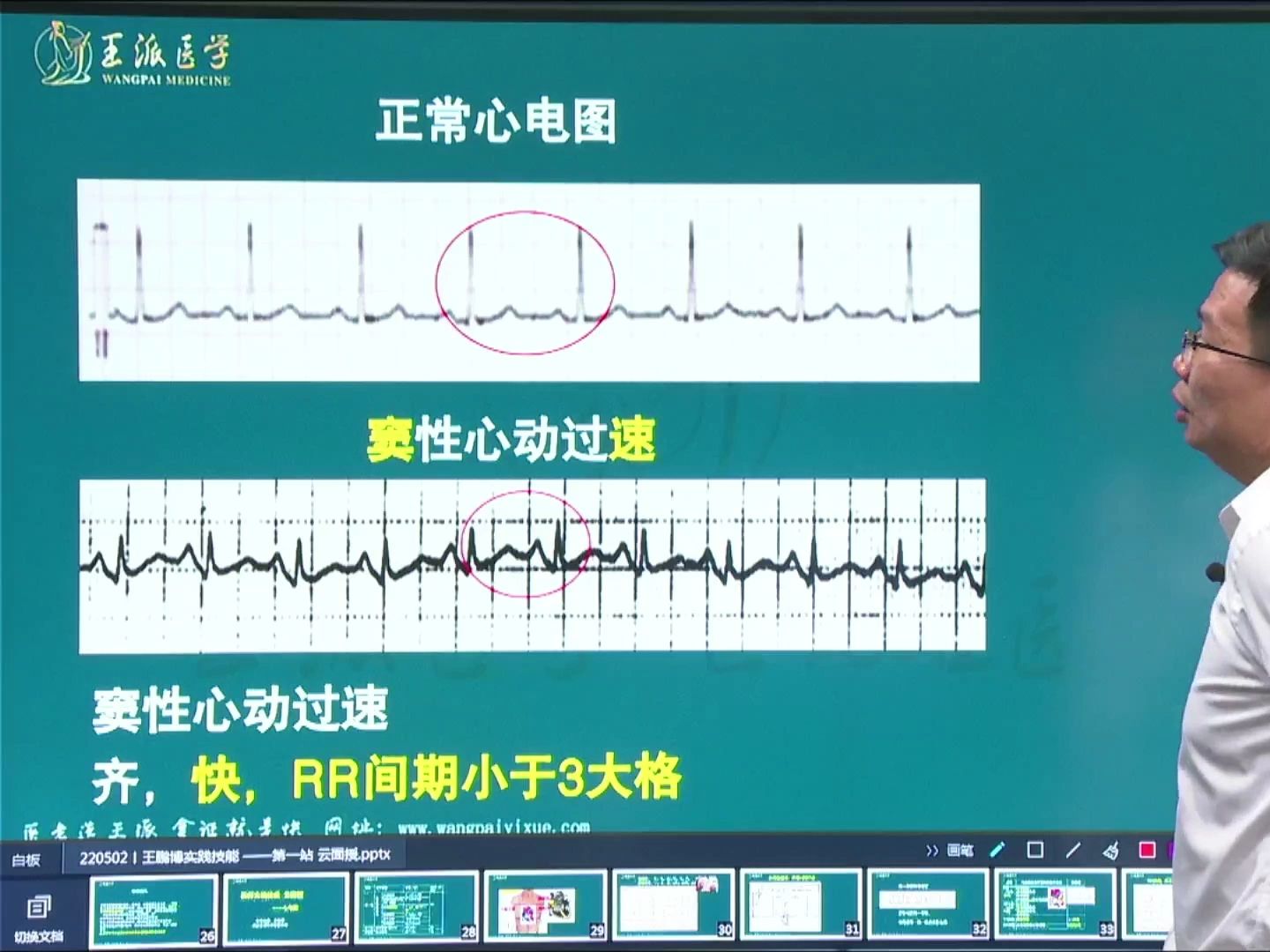 窦性心动过速110严重吗