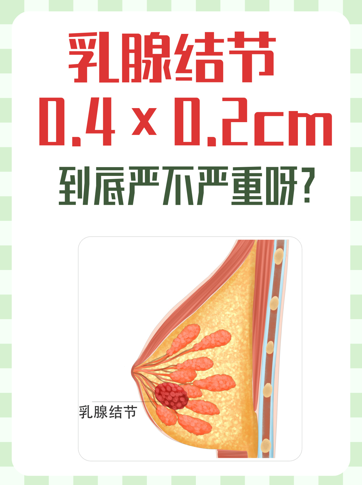 乳腺增生严重吗?