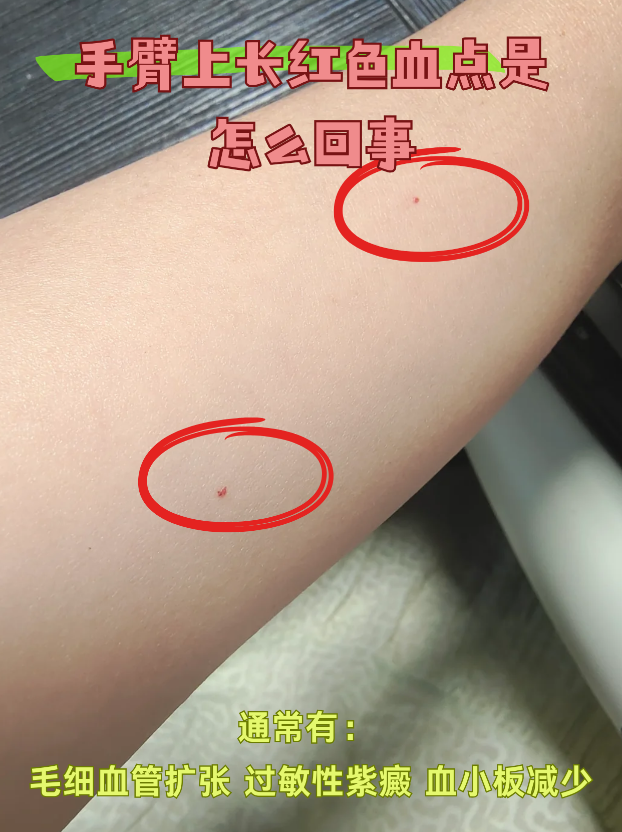 手臂上很多红血点怎么回事