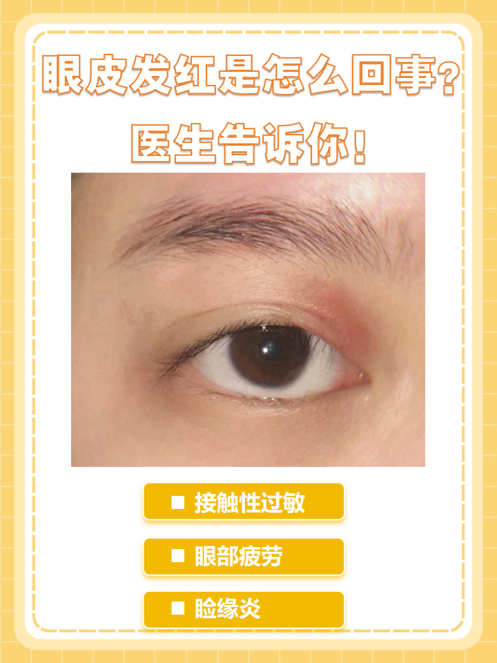 眼皮红是怎么回事