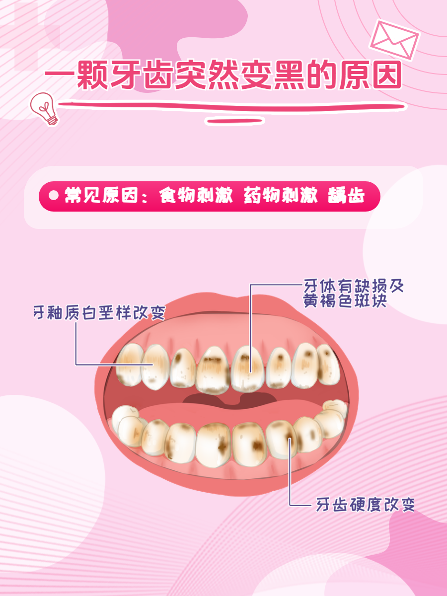 牙齿上有黑点怎么去除