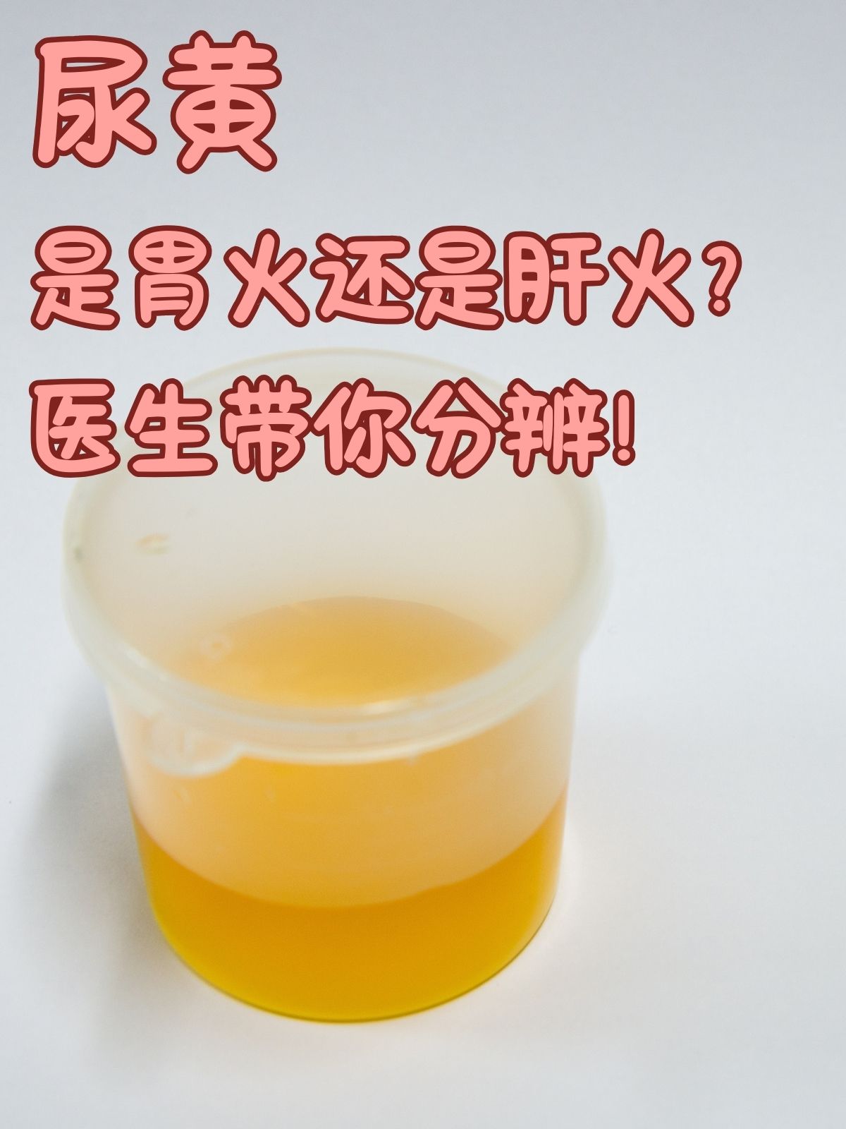 经常尿黄尿是怎么回事