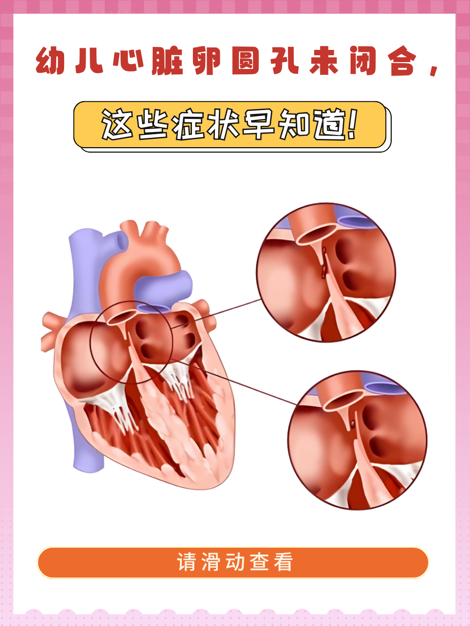 什么是心功能不全