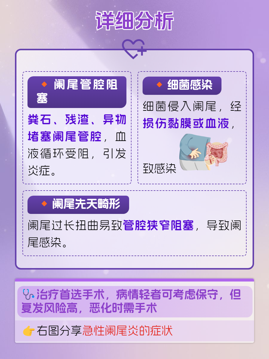 急性阑尾炎怎么造成的