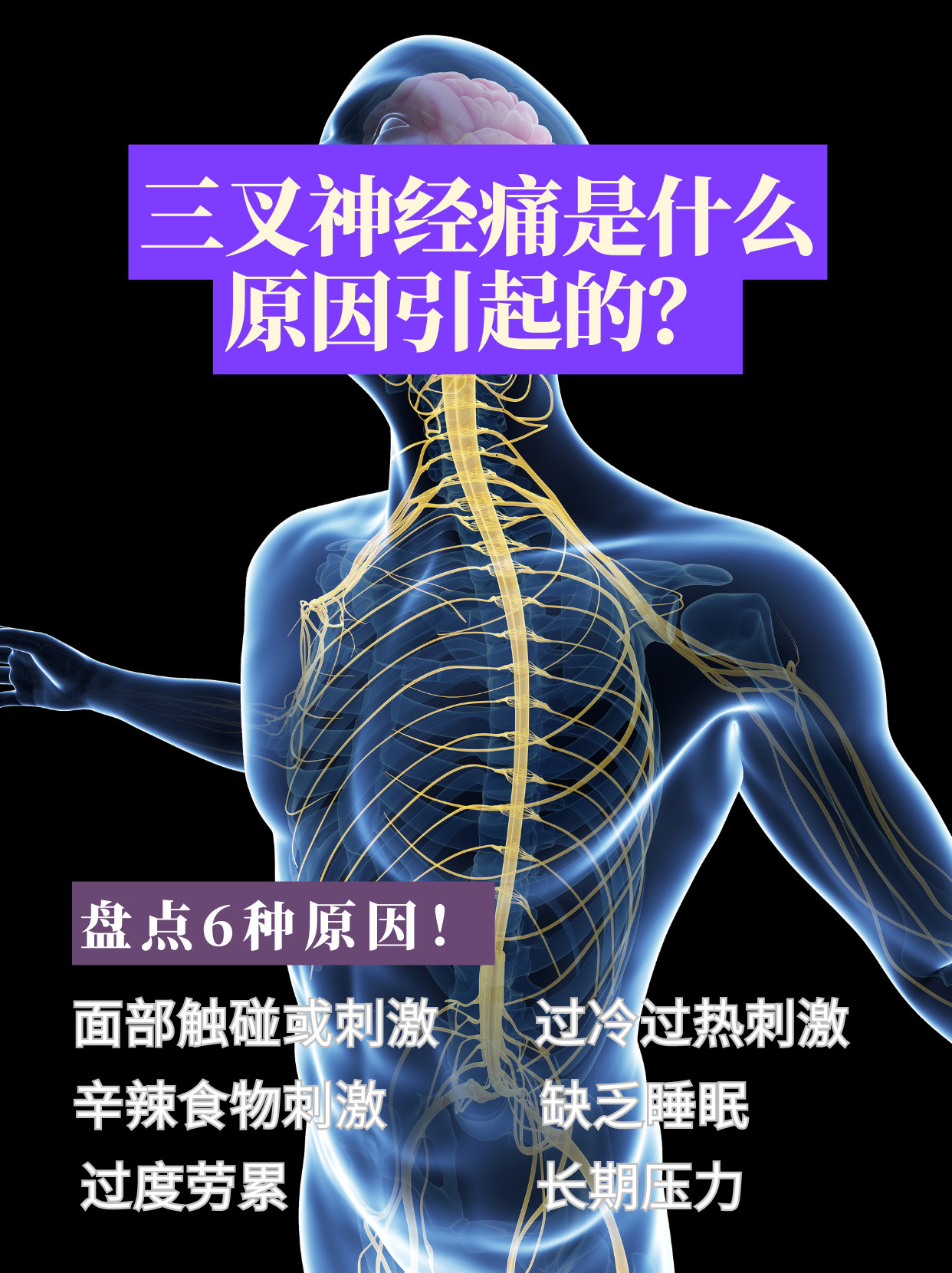 什么是原发性三叉神经痛?