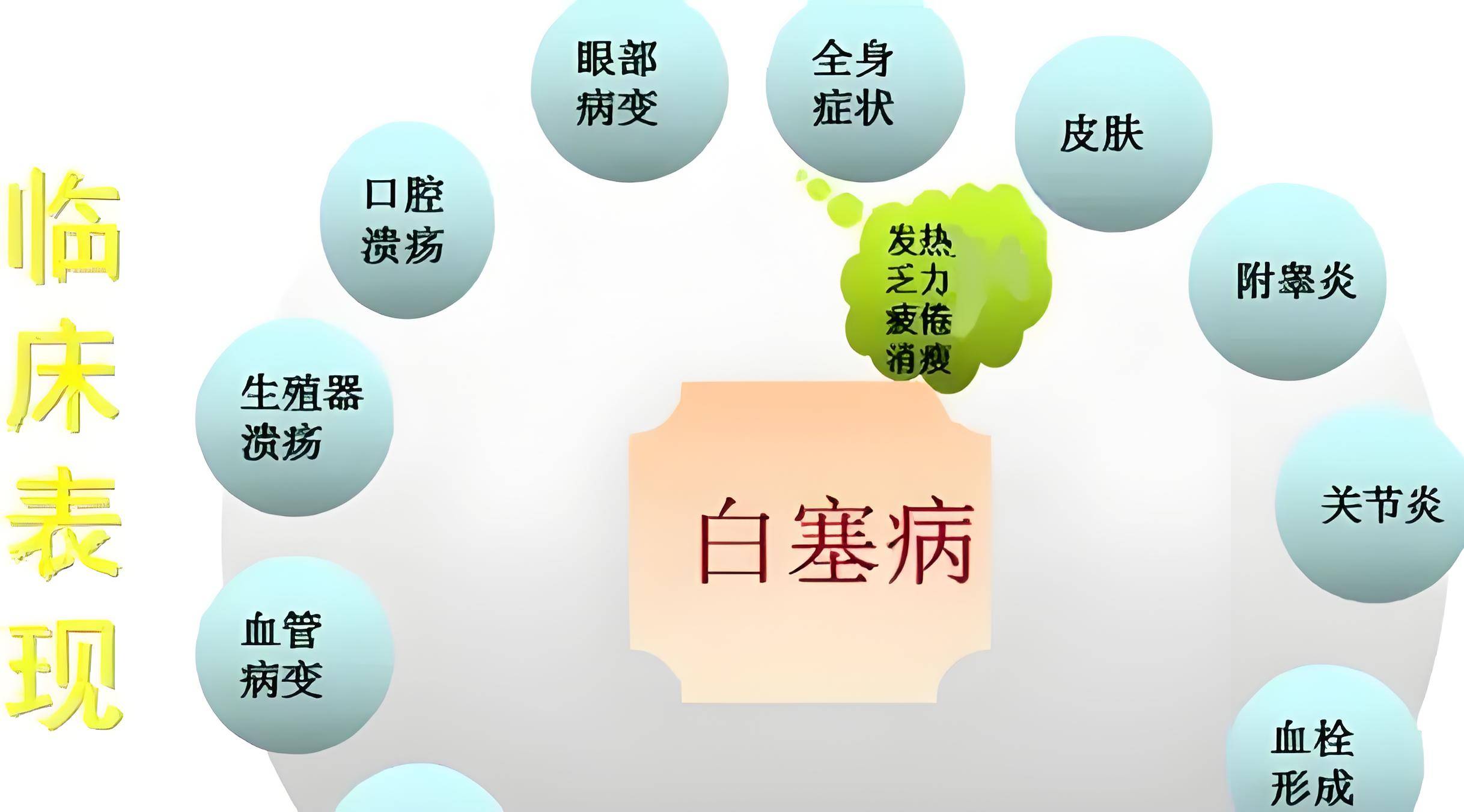 白塞病怎么治疗