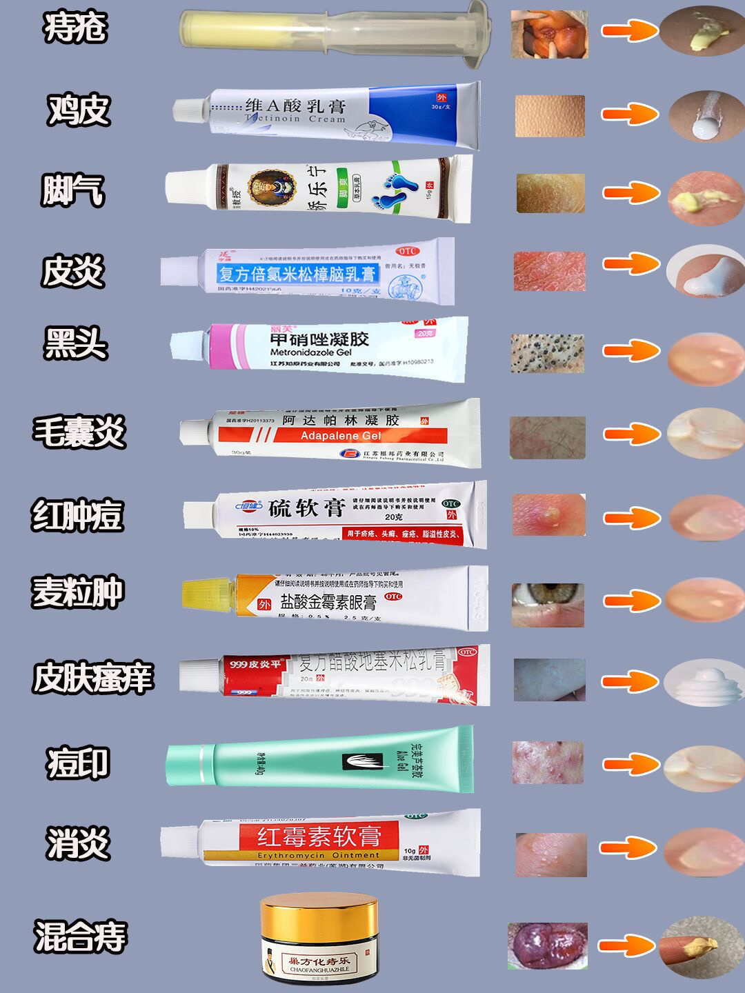 复方硫磺乳膏的效果怎么样