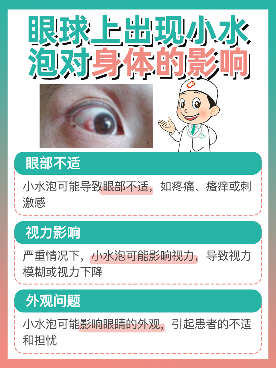 玻璃体混浊怎么治疗