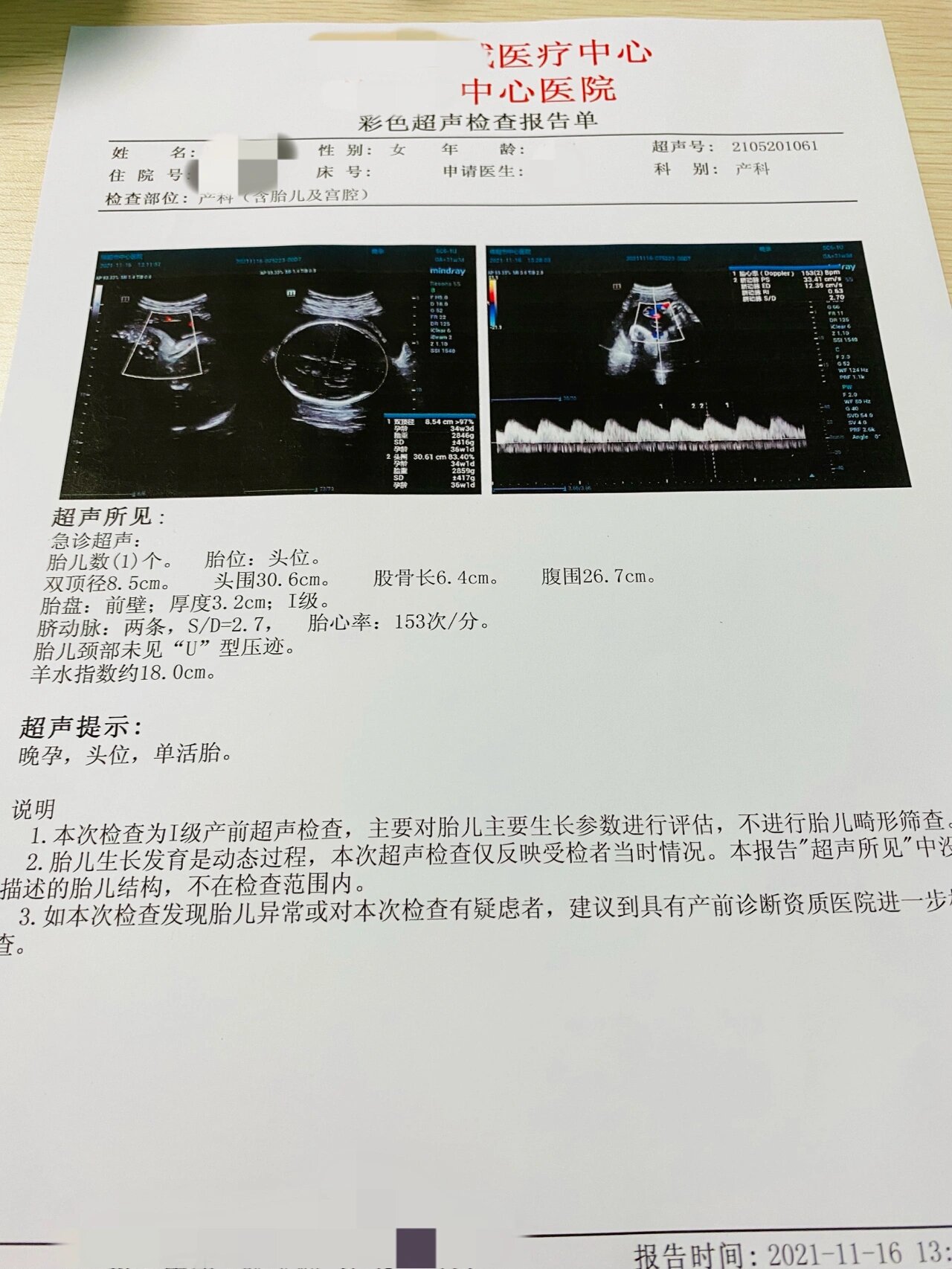 帮我看看胎心监护的结果呗,谢谢医生