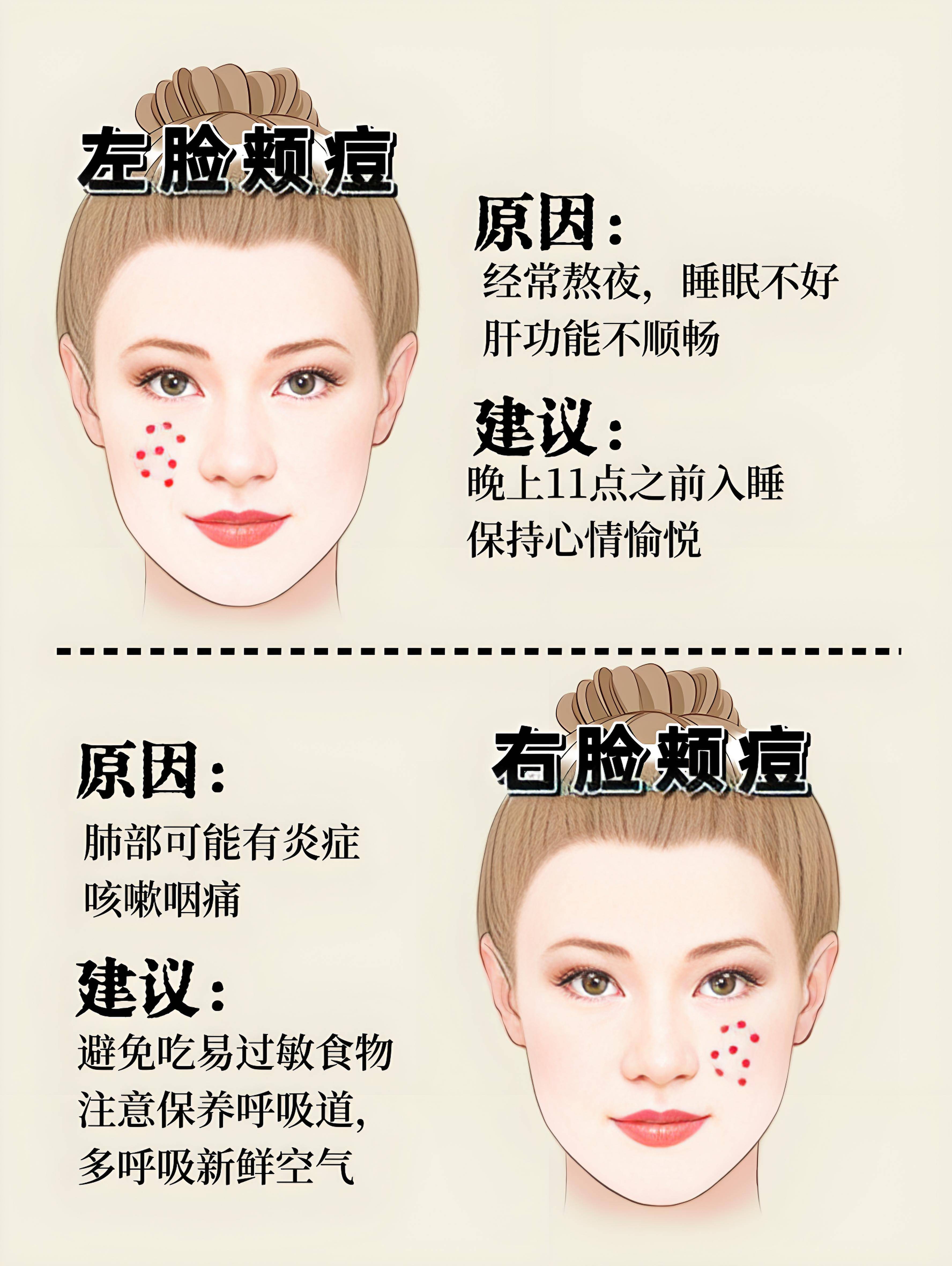 脸部发麻是什么病