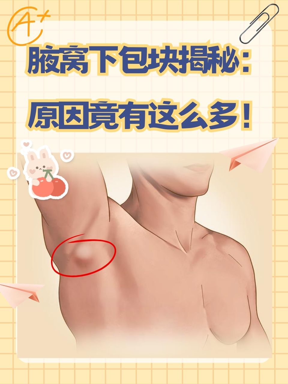 左侧锁骨淋巴结肿大怎么回事?