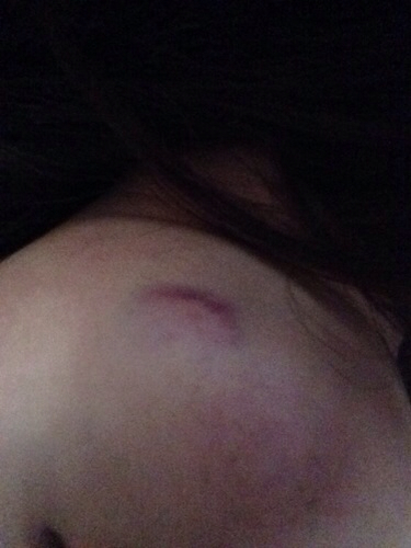 下巴掉了是什么原因