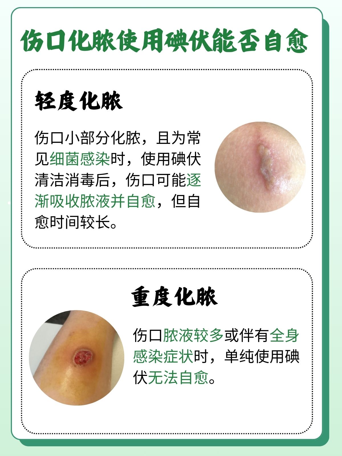 孕妇伤口可以用碘伏吗