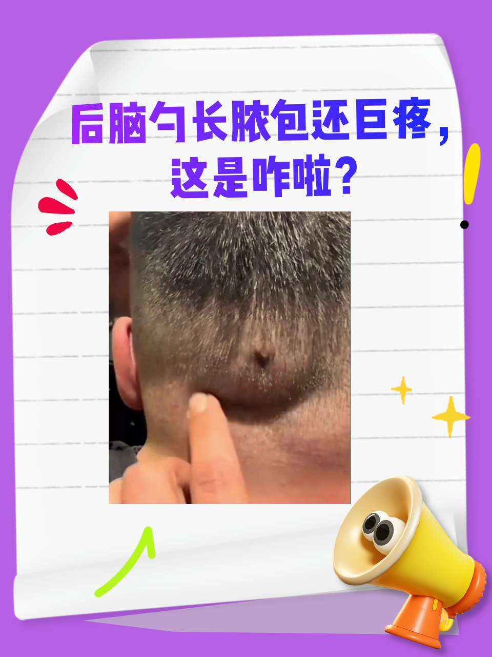 后脑勺疼,一阵一阵的