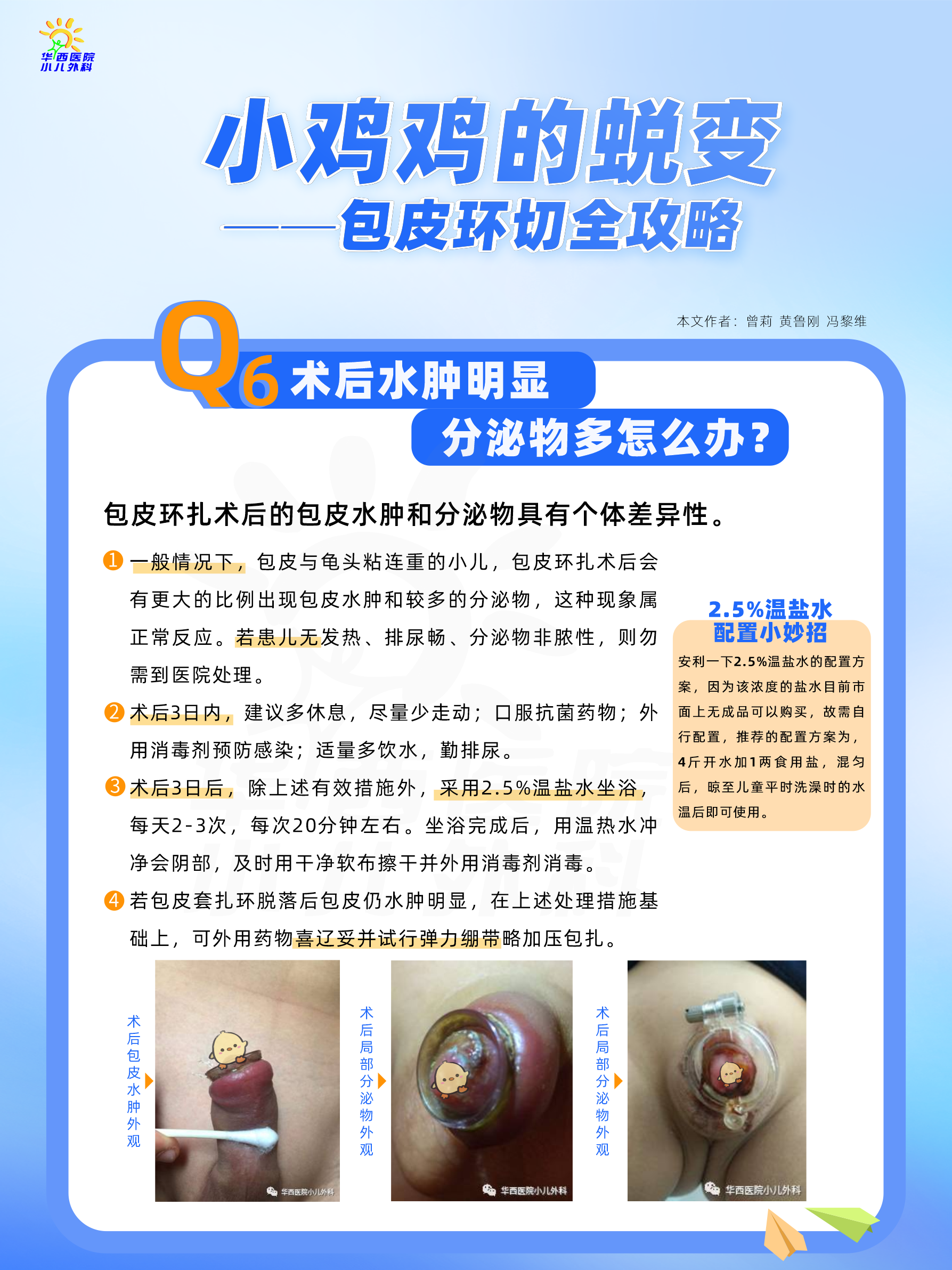 包皮割了能延长时间吗