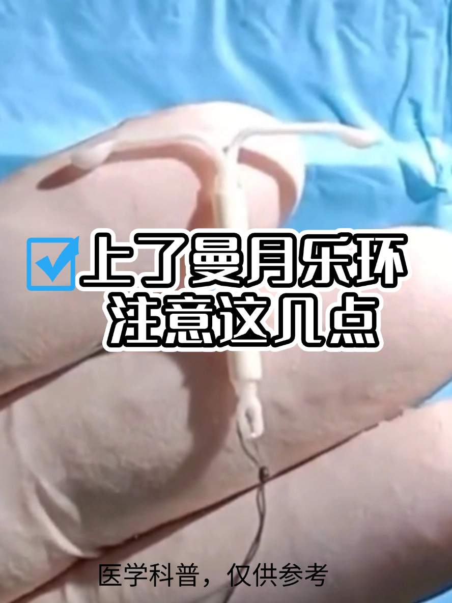 昨天刚带上环.今天感觉有点痒,没事吧?