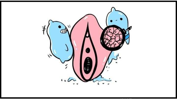 外阴白斑癌变的表现