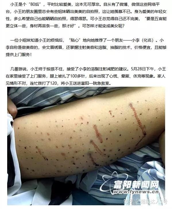 溶脂针有副作用吗